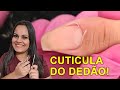 Cutilagem no Dedão, Muitas Peles