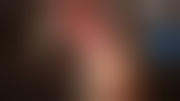 Repositioning Too Short At Subconjunctival Space