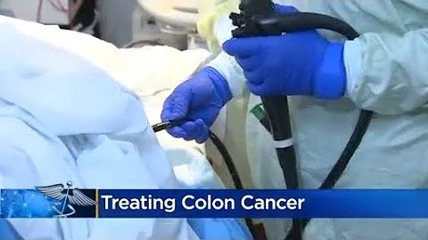 Doctors have new recommendations treating colon cancer