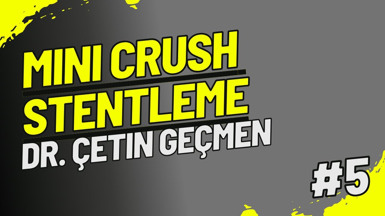 Mini Crush Stentleme Nedir? (İllustrasyon)