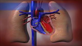 Heart Failure Beating the Odds