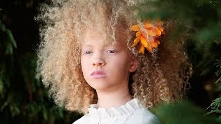 покорили мир моды афроамериканка-альбинос