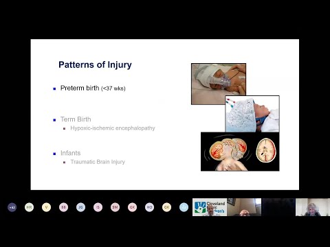Preterm Birth Struggles