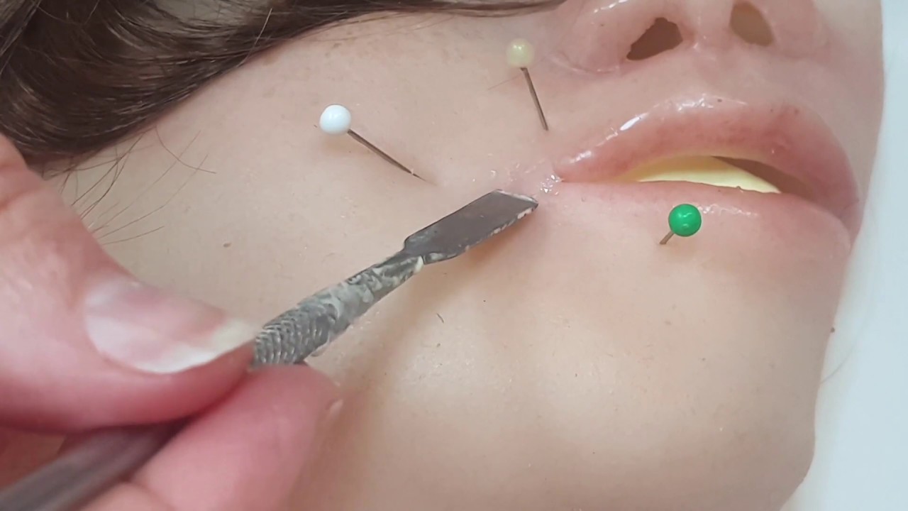 MEDICFX Ripped Face Overlay Repair