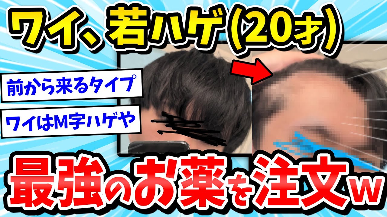 【2ch面白いスレ】ワイくん若ハゲ(20)、最強のお薬を注文してしまうｗｗｗ【薄毛/髪型/メンズヘア/ゆっくり解説】