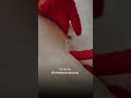 Страшная тема: ботокс в подмышках