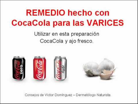 REMEDIO hecho con CocaCola para las VARICES