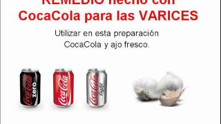 REMEDIO hecho con CocaCola para las VARICES