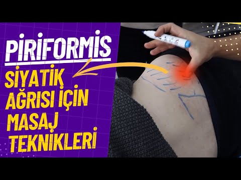 Tetik Nokta Masajı ile Siyatik Ağrısından Kurtul: Piriformis ve Gluteus Kaslarının Sırrı