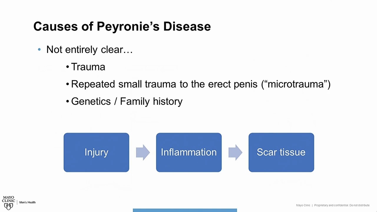 Men's Health Moment: Peyronie's Disease Introduction and Overview - YouTube