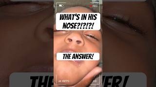 YOU CANT MAKE THIS STUFF UP PART 2- WHAT IS IN HIS NOSE?! THE ANSWER!