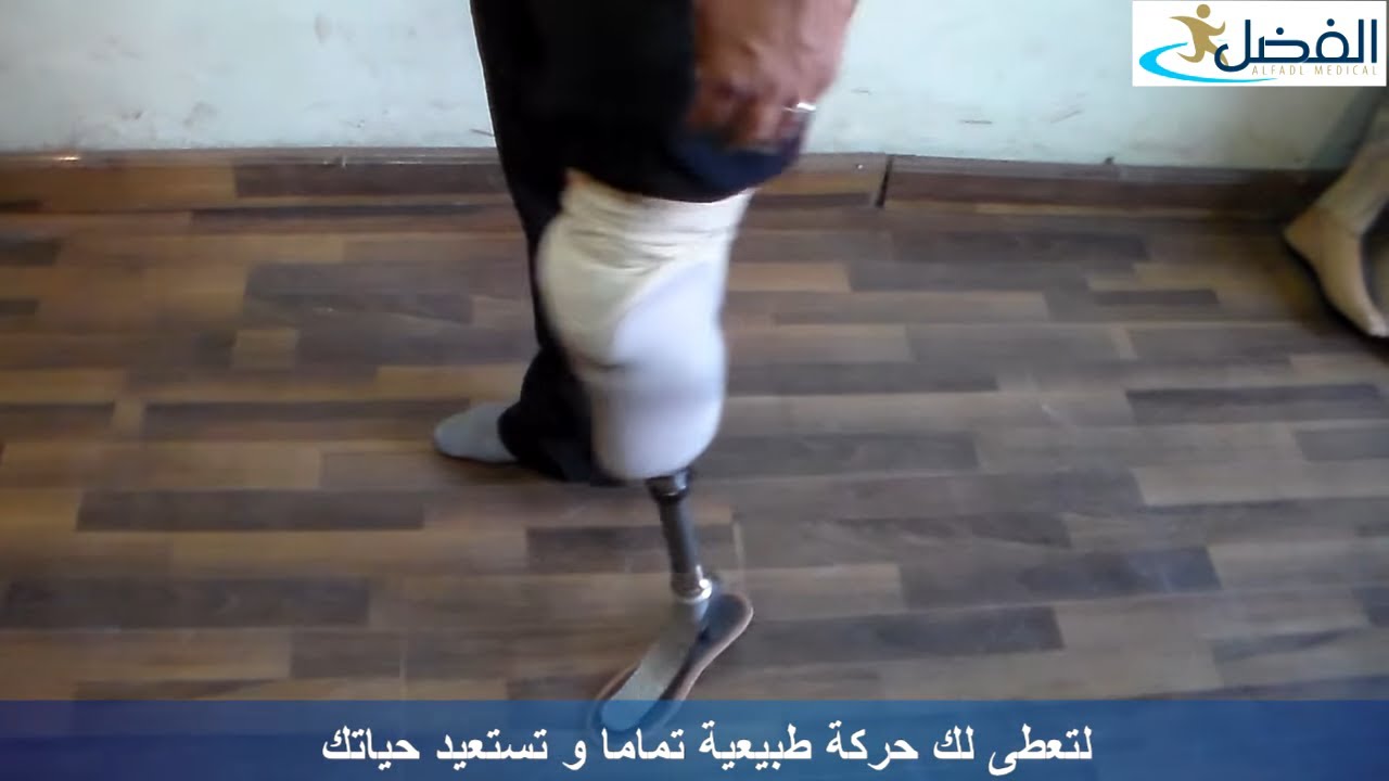 احدث انواع الاطراف الصناعية تحت الركبة الحديثة - قدم متحركة حركة طبيعية - الفضل ميديكال  01094402330