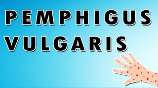 Pemphigus Vulgaris Symptoms, Treatment, and Causes screenshot 3