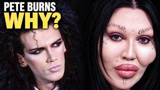 Why Pete Burns Couldnt Stop Changing His Face