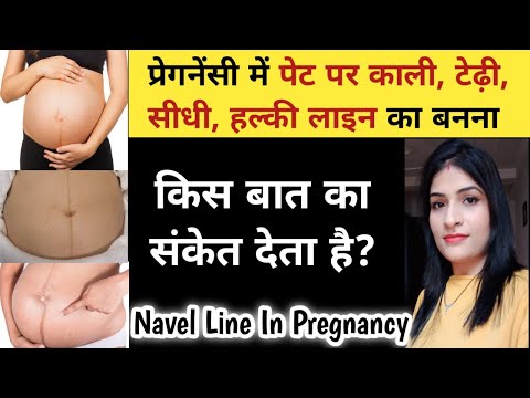 वीडियो: पिपेट पर टीडी का क्या मतलब है?