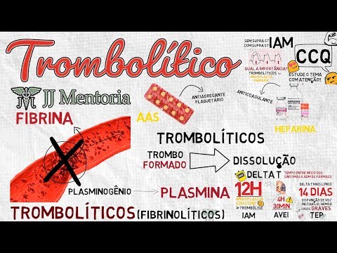 Vídeo: Trombólise: Descrição, Onde é Utilizada, Indicações E Complicações