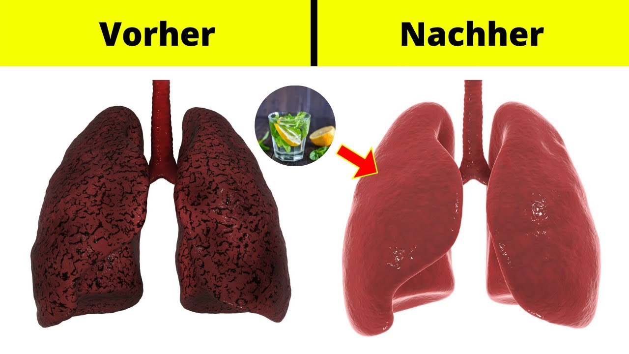 Wie Lange Braucht Eine Raucherlunge Sich Zu Erholen DIESES GETRÄNK REINIGT DEINE LUNGE! [Perfekt für alle Raucher und Ex