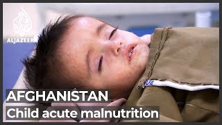 Children in Afghanistan face threat of acute malnutrition: UNICEF