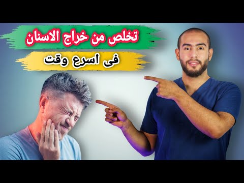 علاج خراج الاسنان بخطوات بسيطه فى المنزل|اهم اعراض ومضاعفات خراج الاسنان |خراج الاسنان بعد حشو العصب