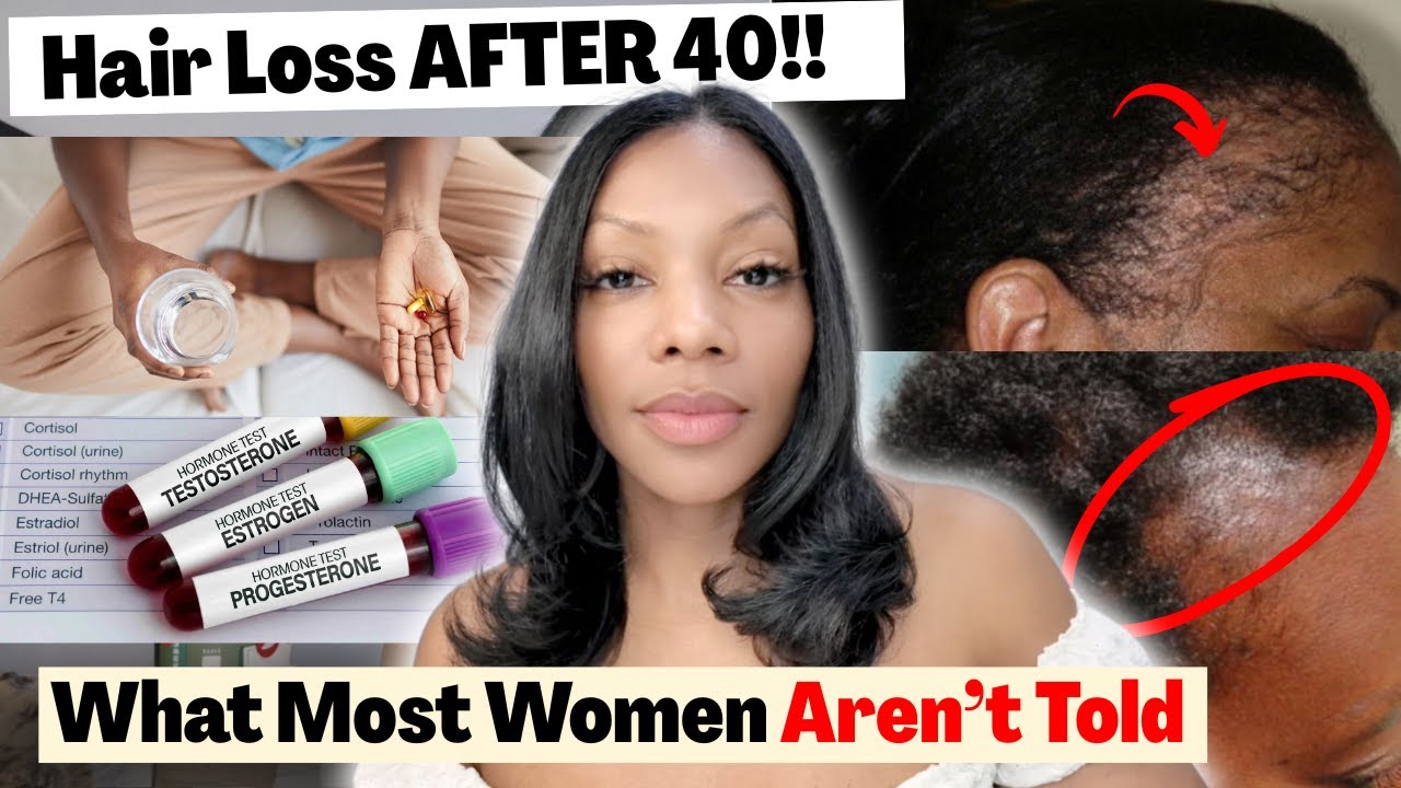 If You’re Over 40, This Is Why Your Hair Is Thinning.. No One Explains This!!
