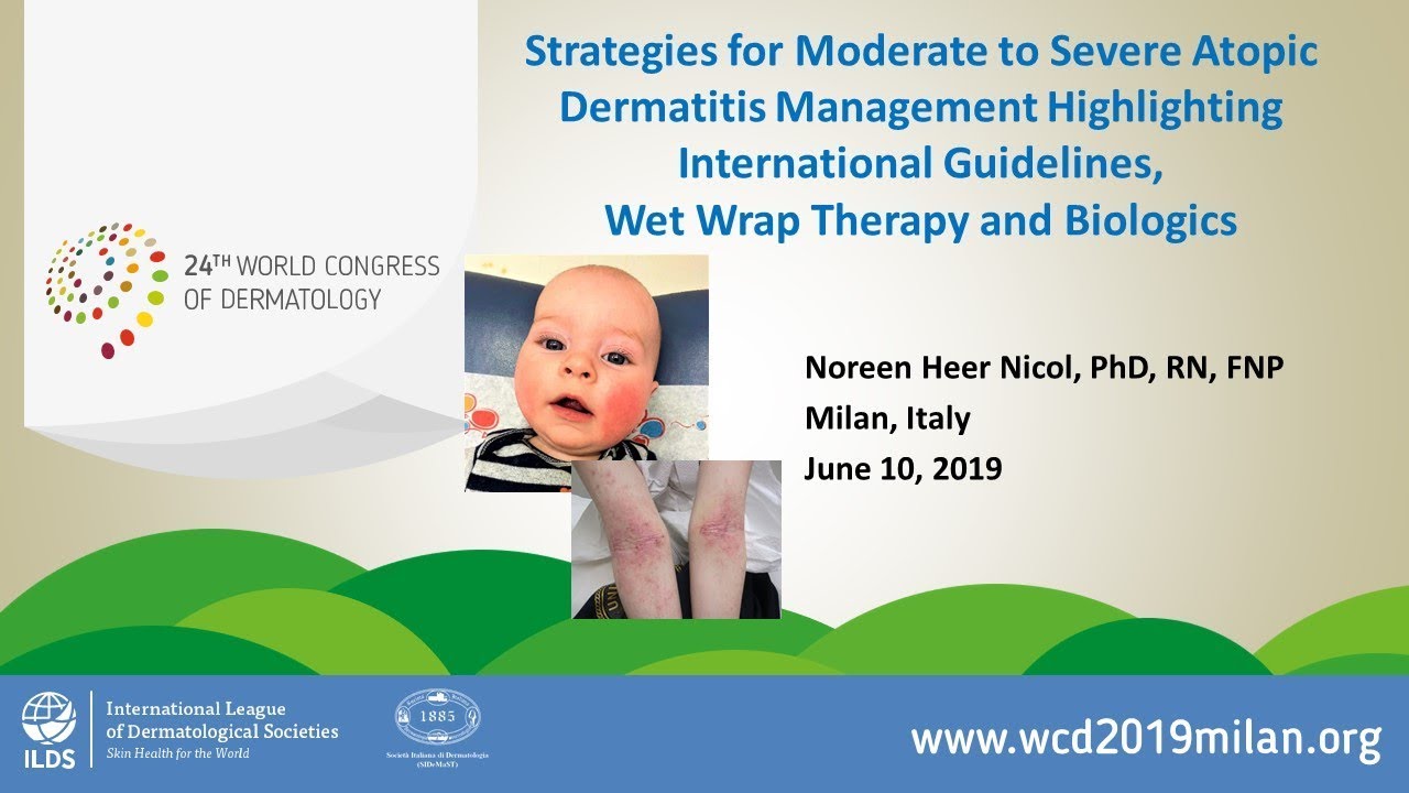 Strategies for Moderate to Severe Atopic Dermatitis Management - YouTube