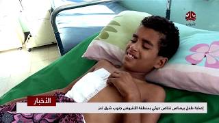 إصابة طفل برصاص قناص حوثي بمنطقة الأقروض جنوب شرق تعز