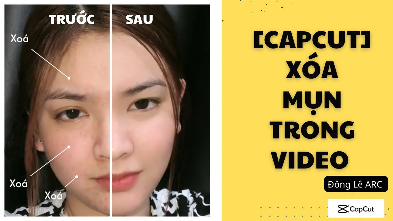 Capcut] Cách Xóa Mụn Trong Video Bằng App Capcut - Youtube