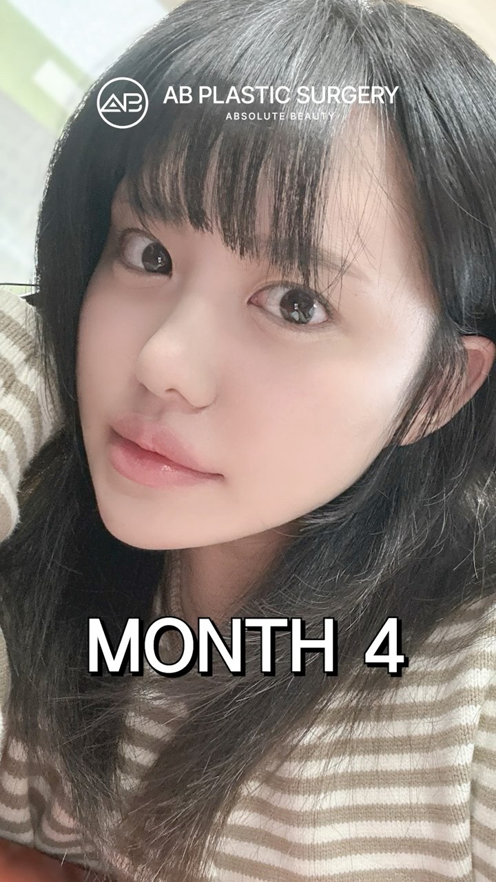 Why Korean Facial Contouring Looks So Natural #shorts