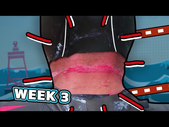 A real pain in the neck. | The Great British Swim: E3
