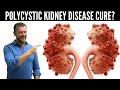 Polycystic Kidney Disease Breakthrough (New Research in PKD) - 2024