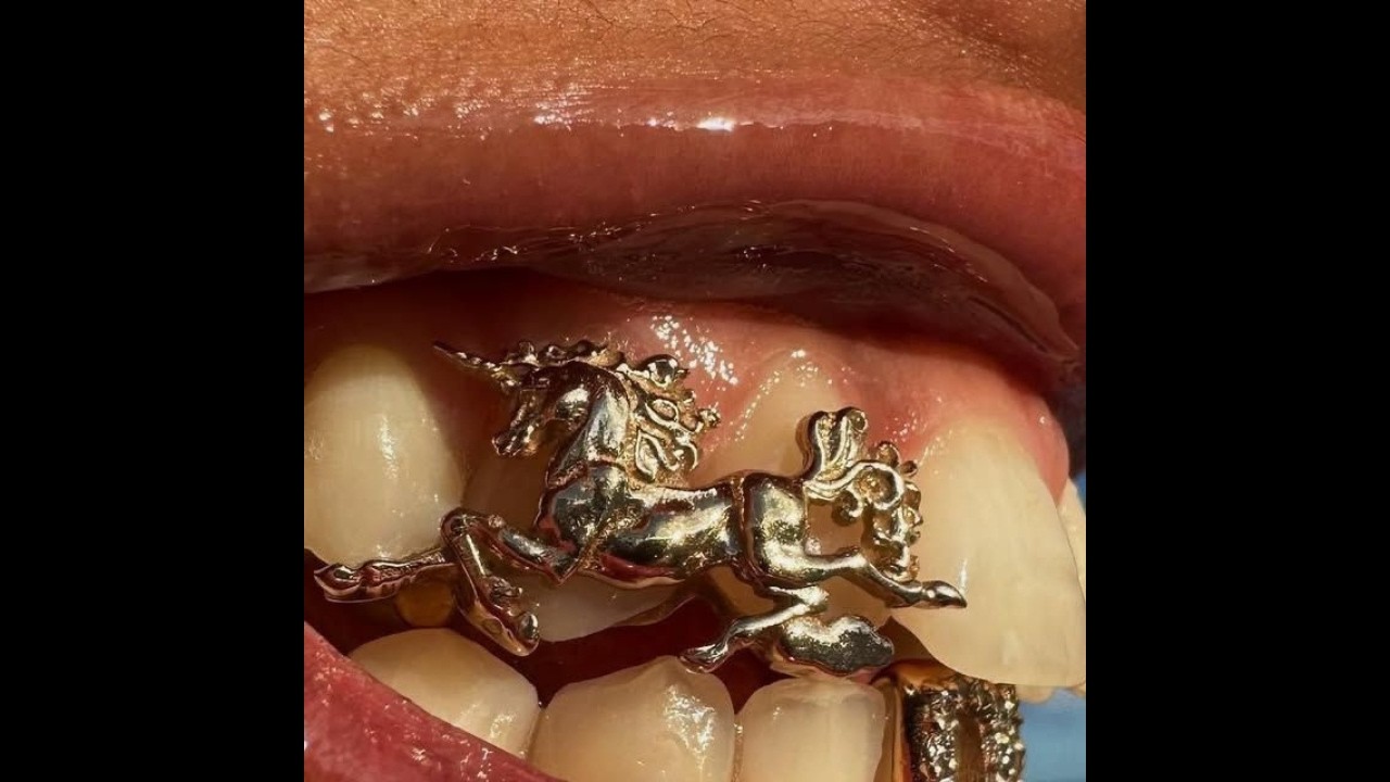 (FREE) Nemzzz x Central Cee Type Beat 