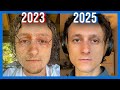 I survived the most painful skin condition. This is what I learned…
