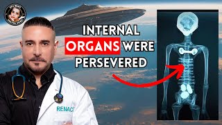 Are the Tridactyl Beings ANCIENT ALIENS The Evidence Part 2