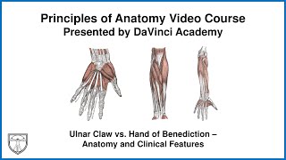 Ulnar Claw vs. Hand of Benediction - Anatomy and Clinical Features [Upper Limb Anatomy 17 of 18]