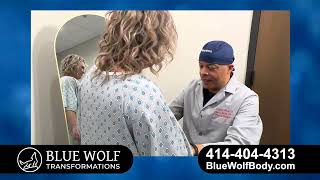 Blue Wolf Transformations Fun Sculpting Procedure