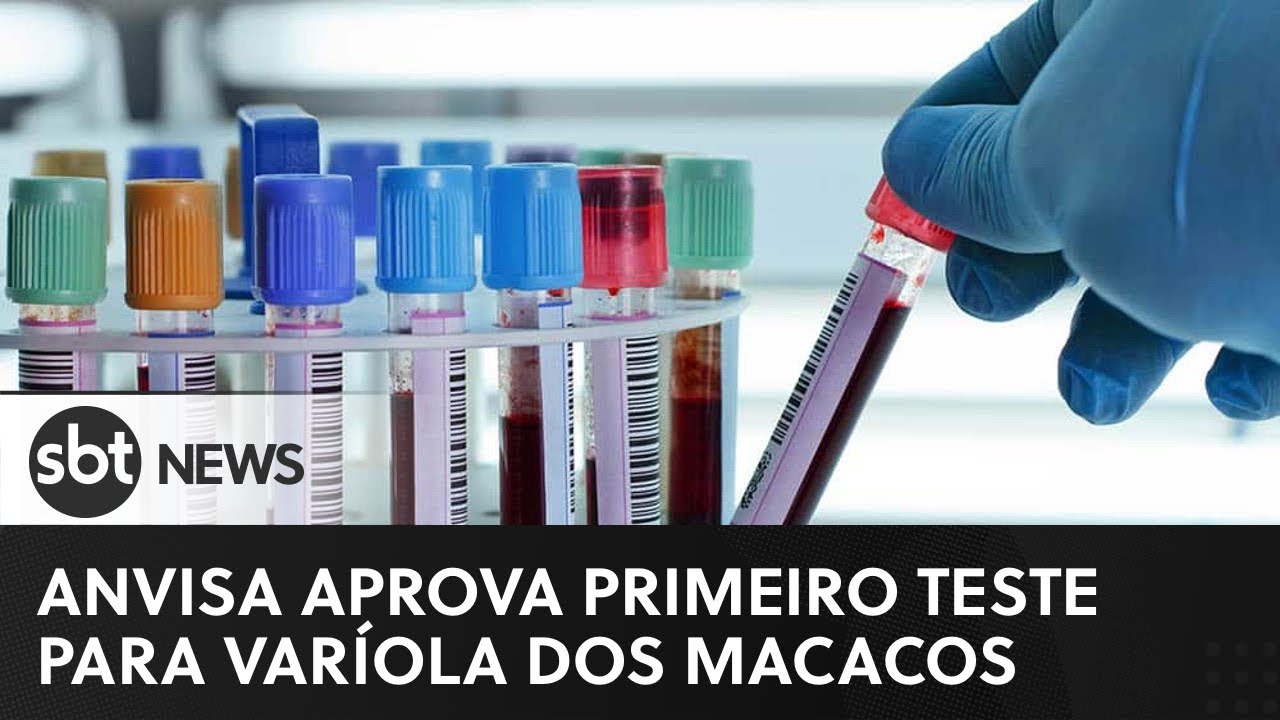 Varíola dos macacos: Anvisa aprova 1º teste para diagnóstico da doença  | Repórter SBT (20/09/22)