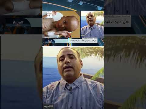 تدهور الأوضاع الإنسانية في اليمن وتصاعد انعدام الأمن الغذائي