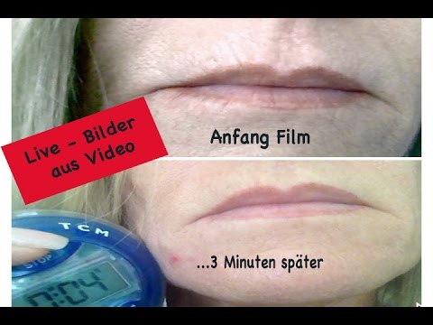 Lippenfalten Mundfalten Weg Bekommen Und Das Im Sekundentakt Unglaublich Youtube