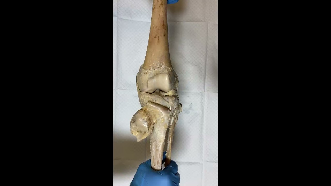 Knee Joint