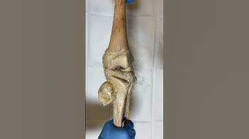 Knee Joint