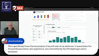 Famous Understanding ePICL CCI  Oucome Data Net Worth