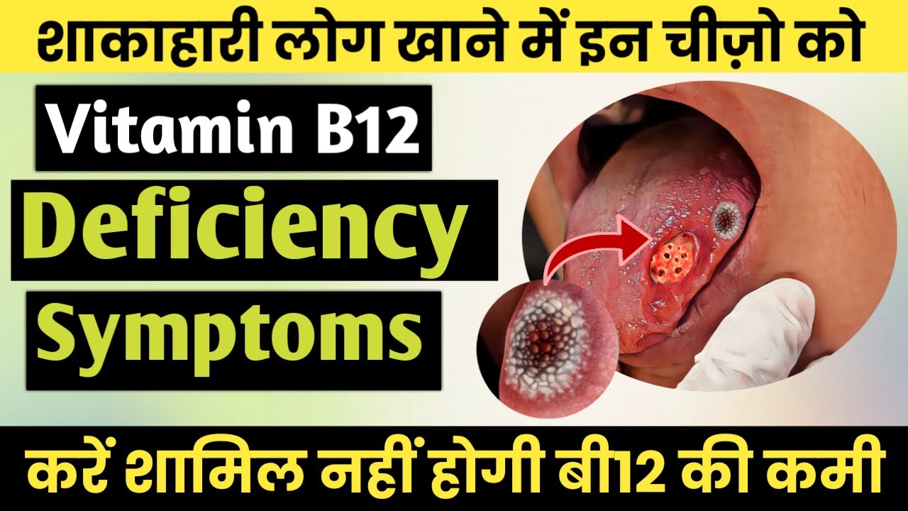 Vitamin B12 Foods For Vegetarians what happens when your vitamin B12