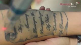 ReversaTatt Tattoo Removal