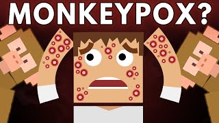 What Does Monkeypox Do To Your Body