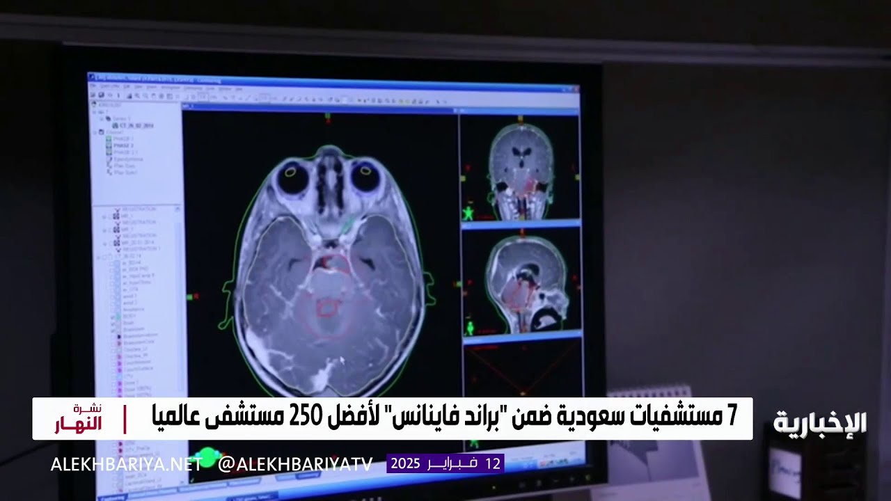 7 مستشفيات سعودية ضمن أفضل 250 مستشفى عالميا