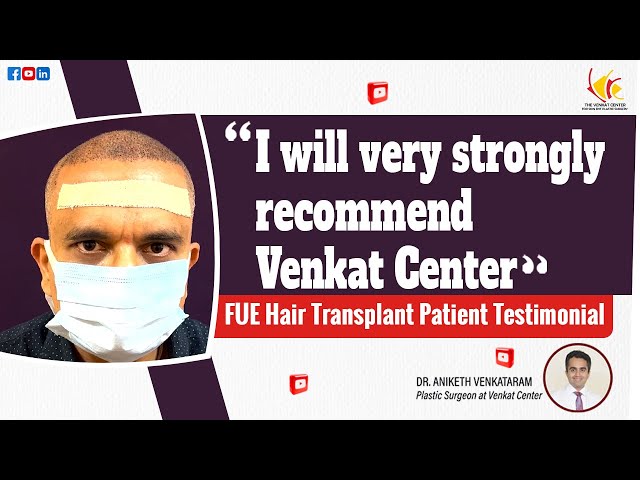 FUE Hair Transplant Testimonial | Day 1 Update | Venkat Center Bangalore
