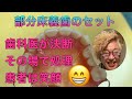 部分床義歯のセット