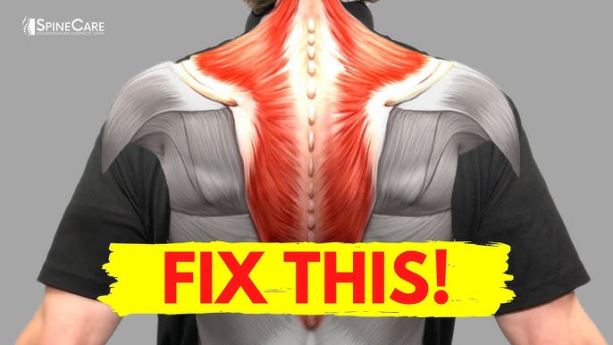 How to Get a Trapezius Knot Release