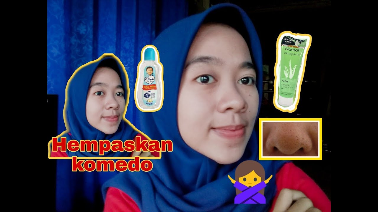 CARA MENGHILANGKAN #Komedo permanen || Terbukti AMPUH !! 