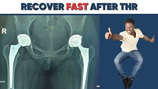 How to recover fast after THR Update
